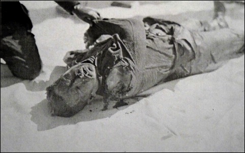 The Deschutes County coroner examines the peculiar shoulder wound of Marine Corps veteran and victim Harry LeRoy Wilson.