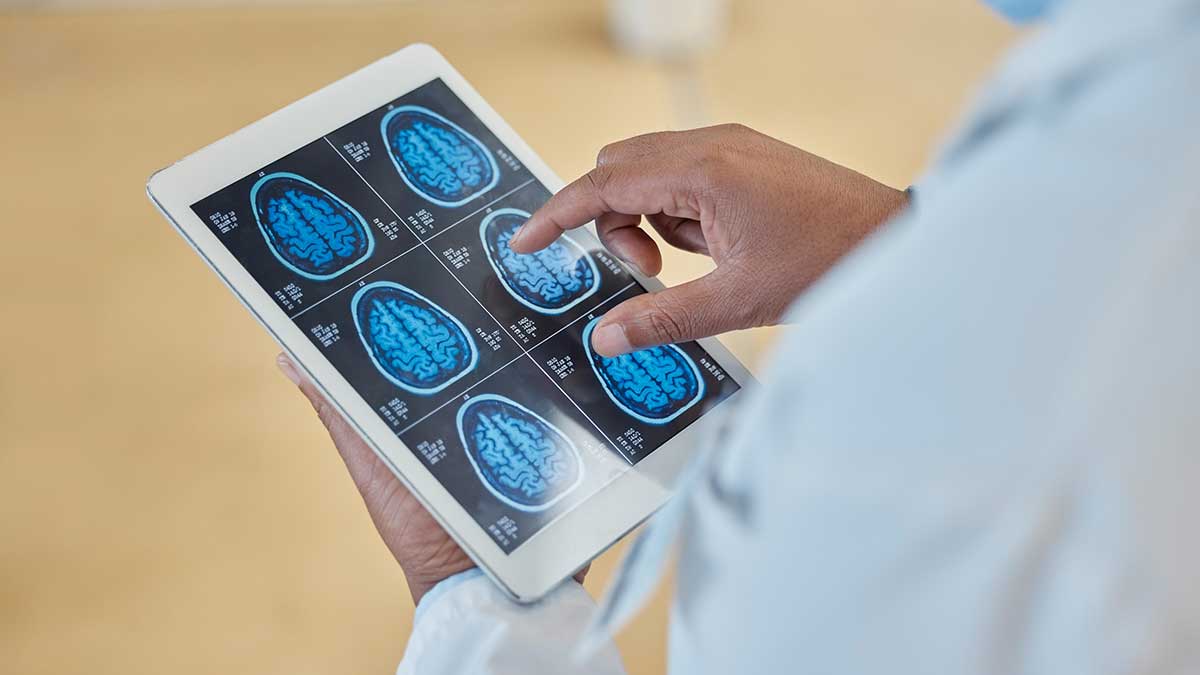 brain_check brain scan, xray and closeup