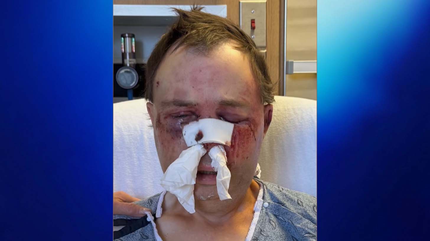 blue news Steve Wilson was a victim of an attack in Prineville, Oregon